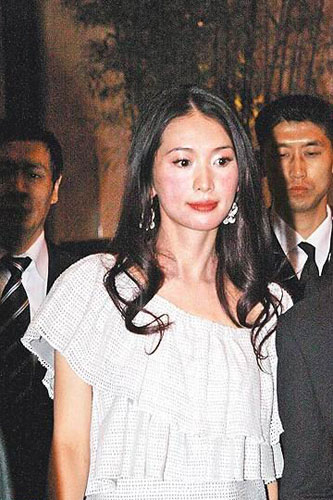 明星怪病纏身惹尷尬 盤點明星那些尷尬事(組圖)